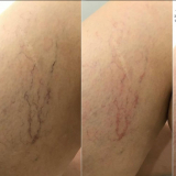 Click for full image Image #11 for Evolution Laser Clinic