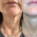 Click for full image Image #14 for Evolution Laser Clinic