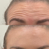 Click for full image Image #2 for Evolution Laser Clinic