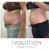 Click for full image Image #3 for Evolution Laser Clinic