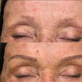 Click for full image Image #4 for Evolution Laser Clinic