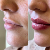 Click for full image Image #8 for Evolution Laser Clinic