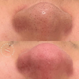 Click for full image Image #9 for Evolution Laser Clinic